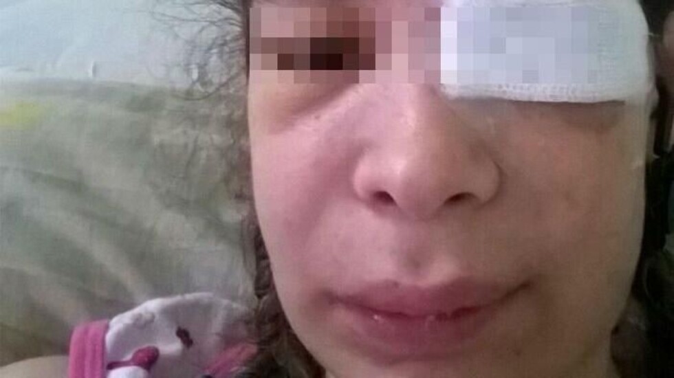 Amamantaba a su bebé y su novio le disparó en el ojo