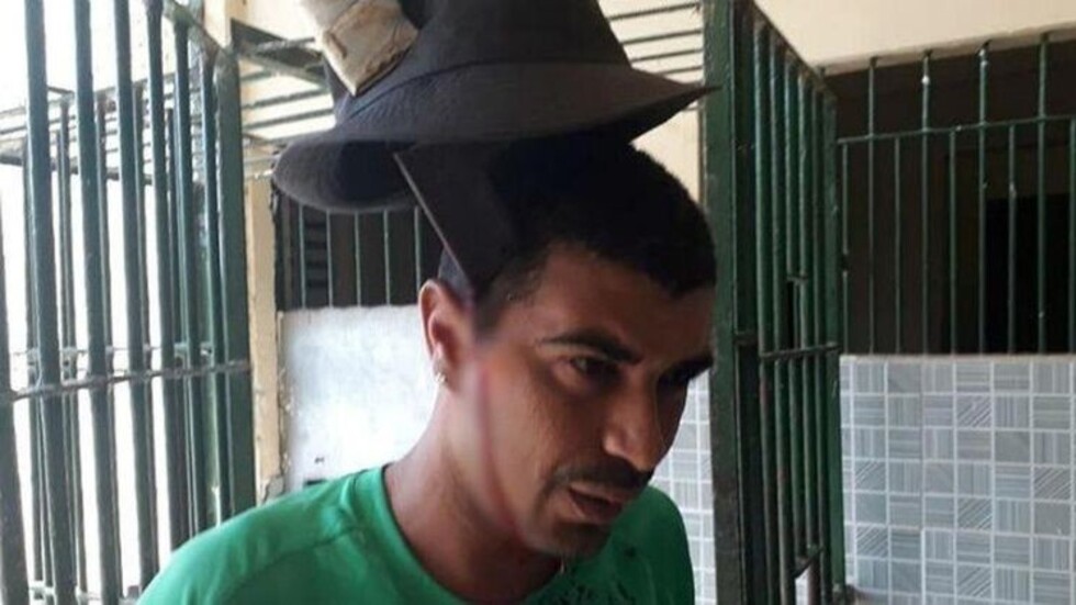 Le clavaron machete en la cabeza y sobrevivió