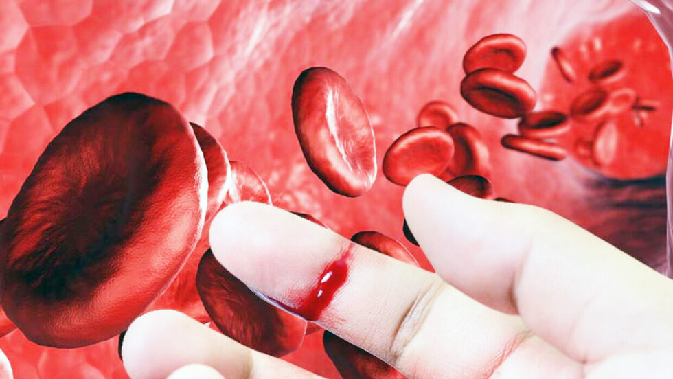 Reportan 4 pacientes con hemofilia en Tarija