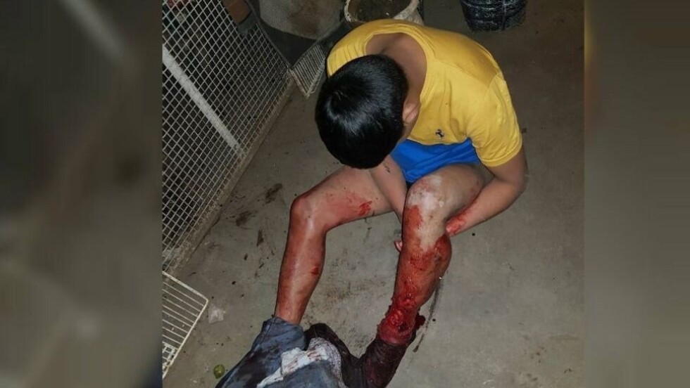 Un pitbull casi arrancó la pierna a un ladrón