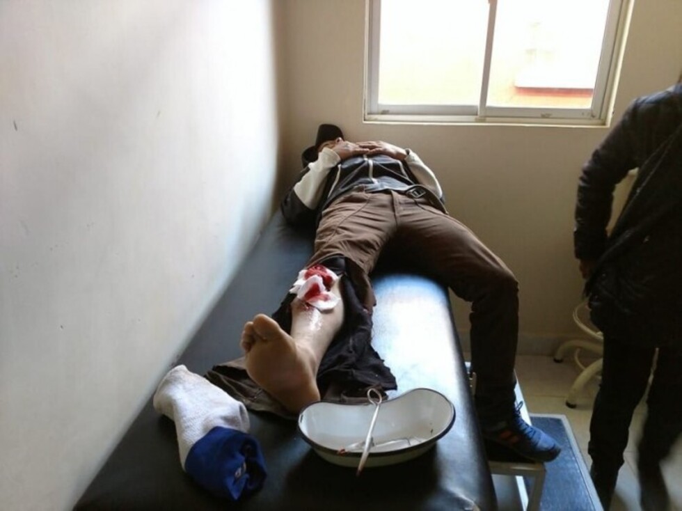 Motociclista  se fractura  el pie tras un choque