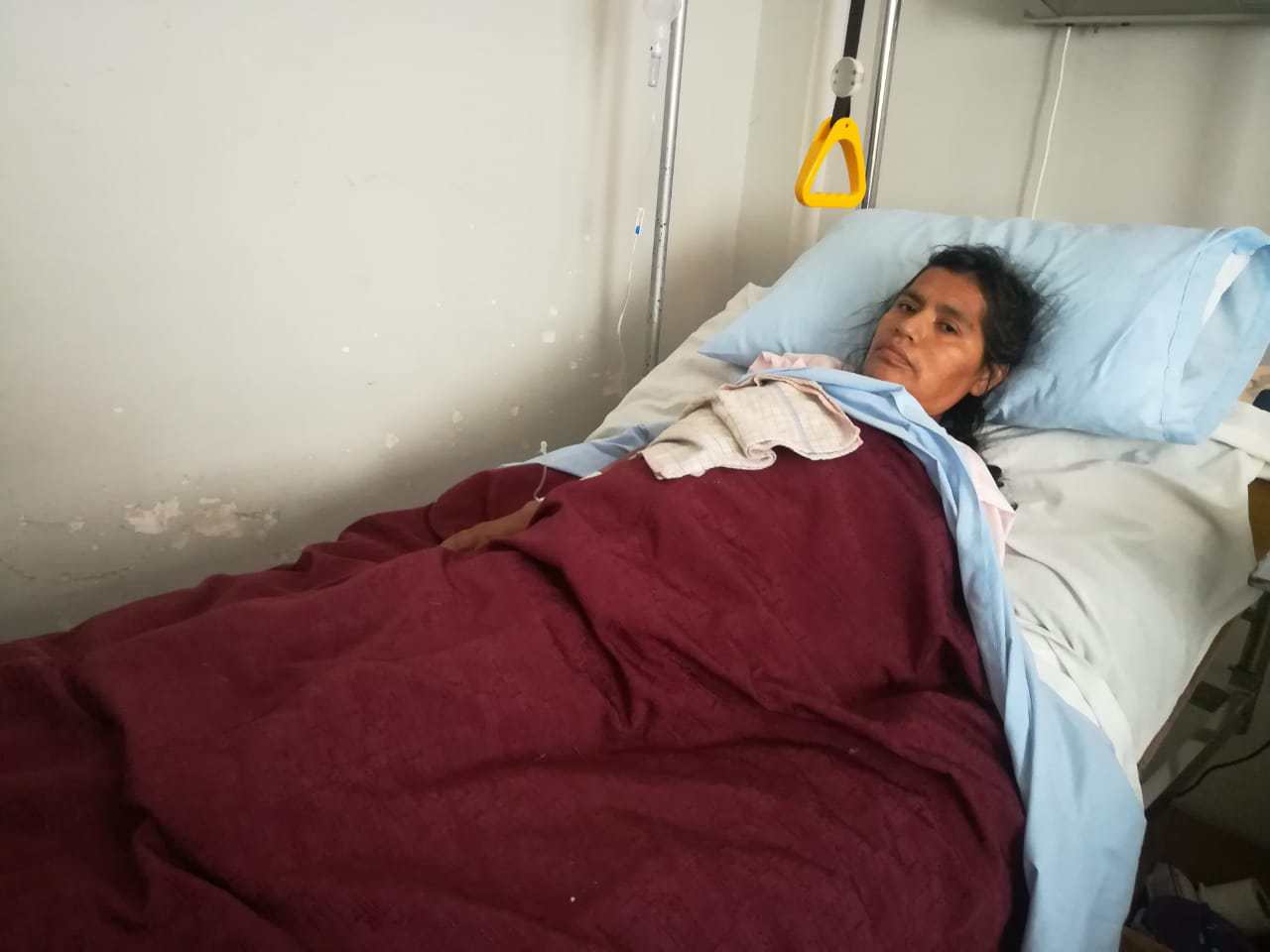Le amputaron las piernas debido a que la atropellaron
