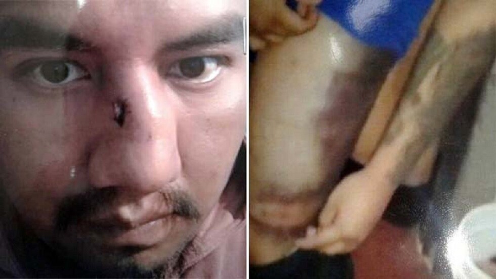 Abogado denuncia que Juan Pari recibió brutal golpiza