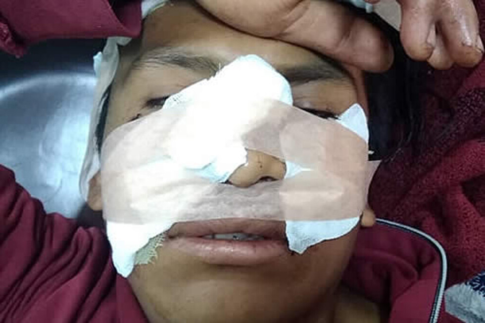 Estudiante sufre 13 cortes en la cara tras ser asaltado