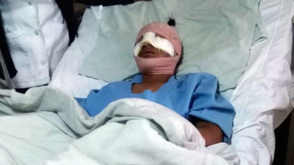 Joven que sufrió 13 cortes en el rostro necesita ayuda