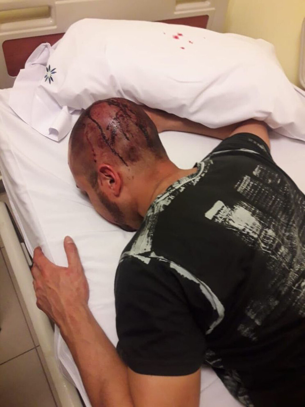 Delincuentes le partieron la cabeza a un hombre
