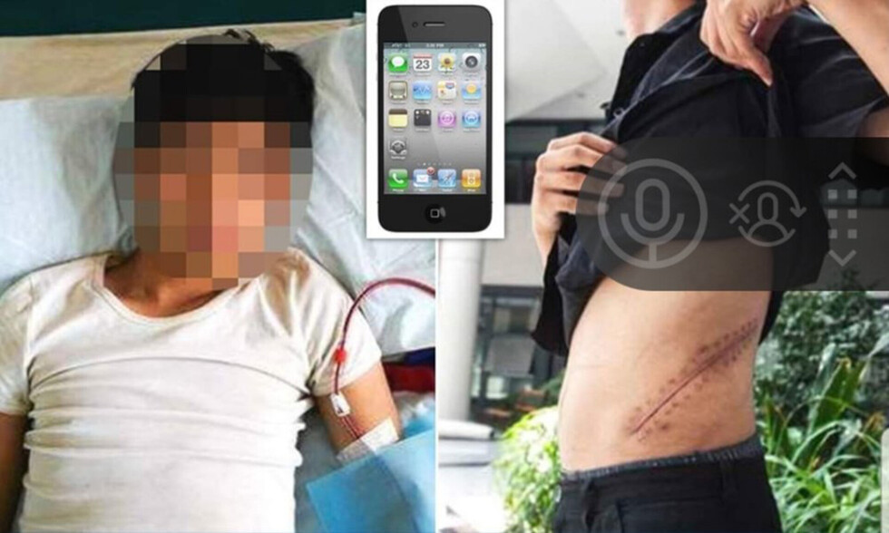 Vendió su riñón para comprarse un iPhone