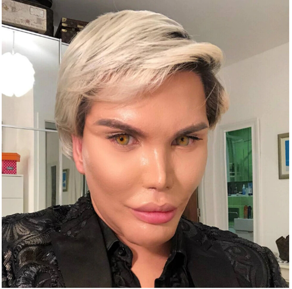 “Ken humano” tiene roto   su mentón