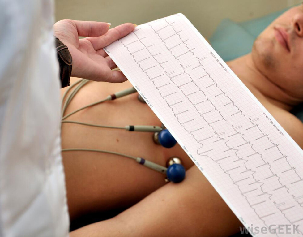 Tarijeños en riesgo, ¿Cuándo debemos visitar al cardiólogo?