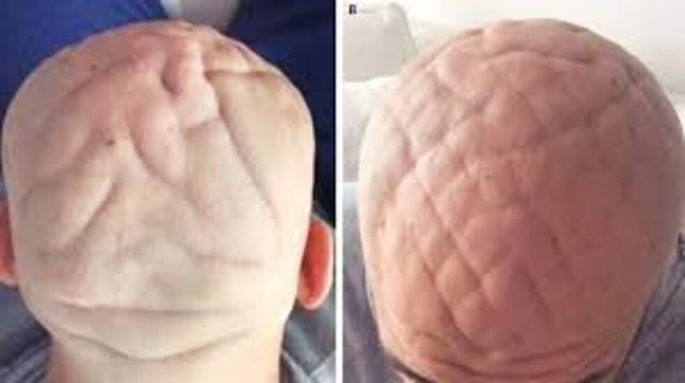Hombre tiene cabeza con forma de cerebro