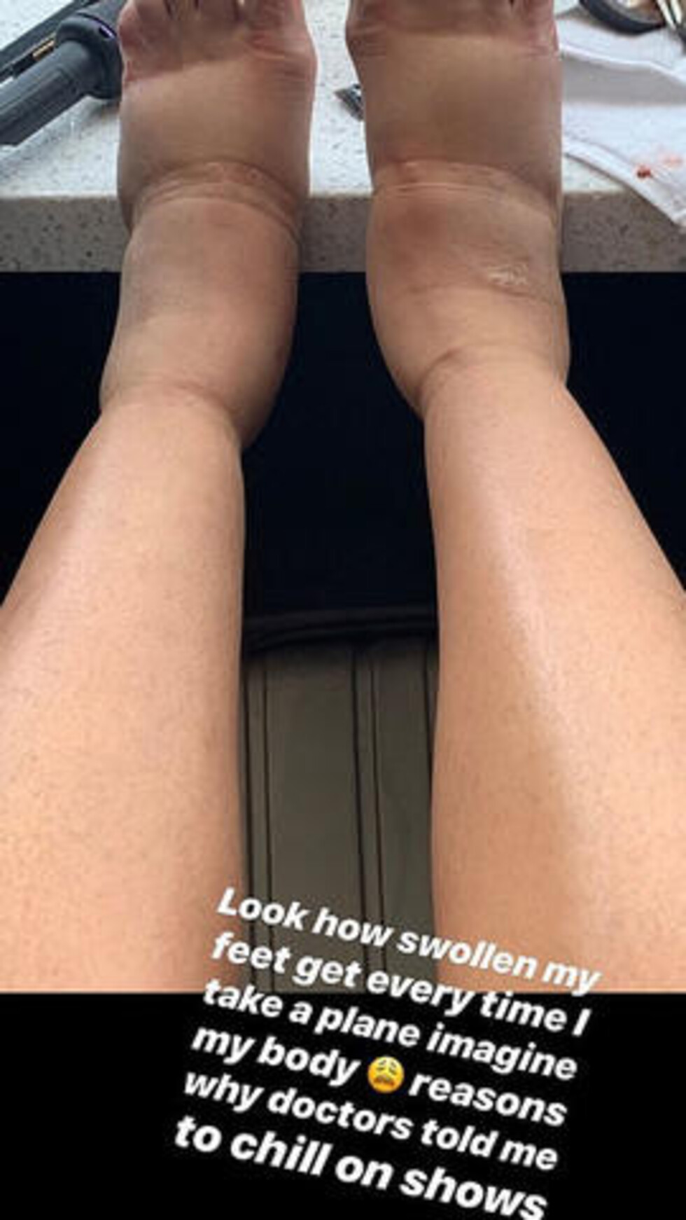 Cardi B jura  que no se hará más cirugías