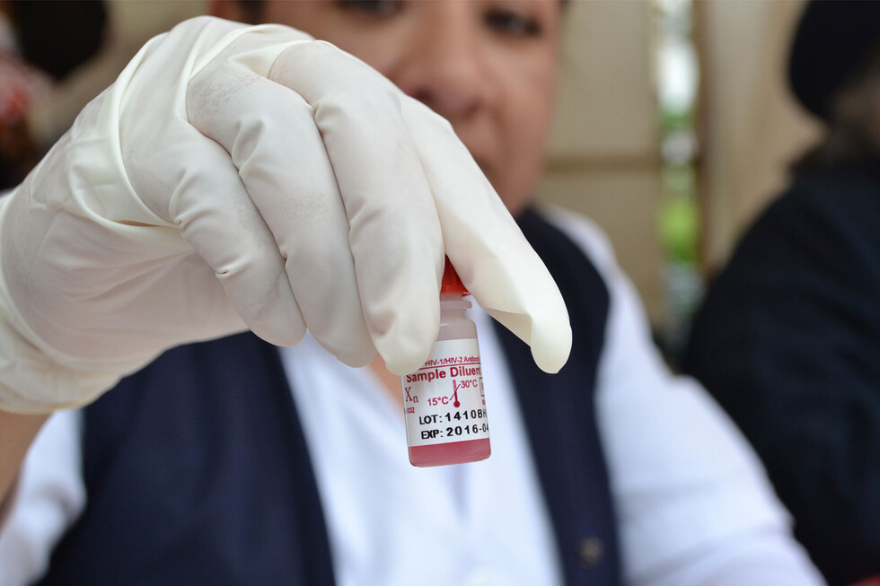 Infecciones de transmisión sexual: su aumento preocupa a los expertos