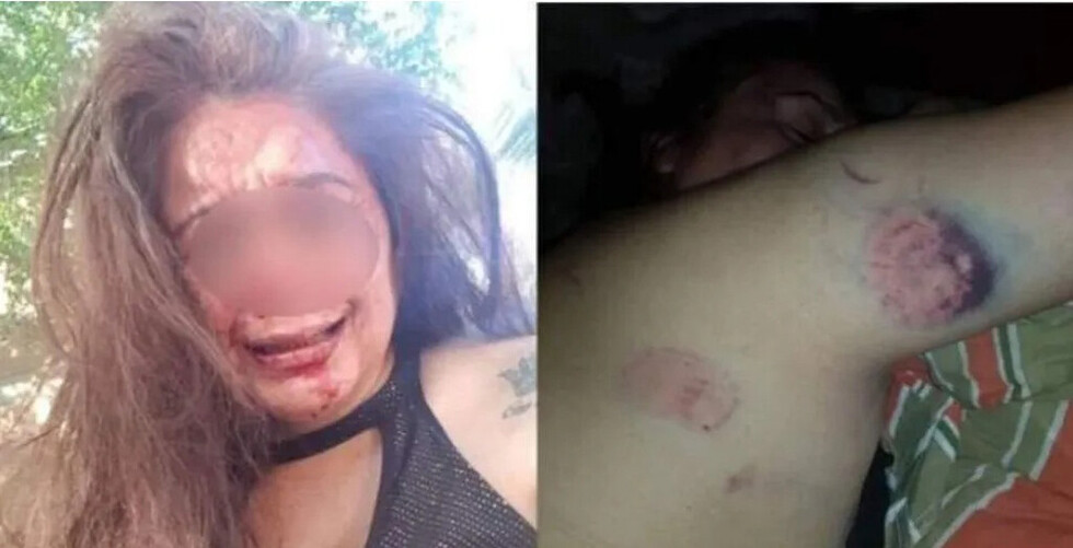 Policía golpeó a su esposa tras reclamó de infidelidad