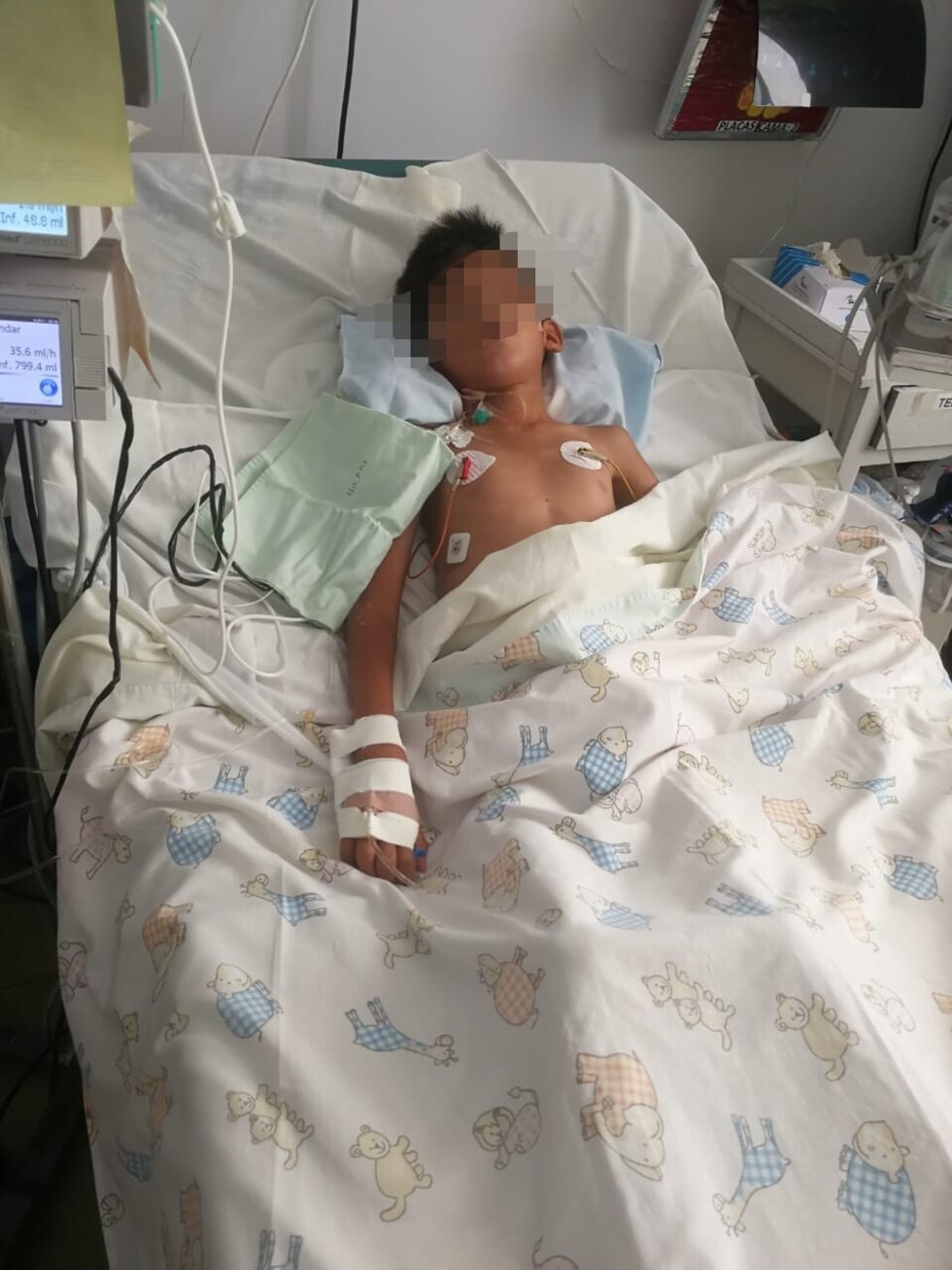 Menor golpeado por su padre en Yacuiba se encuentra en terapia intensiva