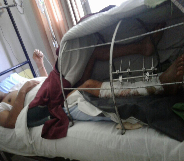 Quedó incapacitado tras golpiza de dos borrachos en Tarija