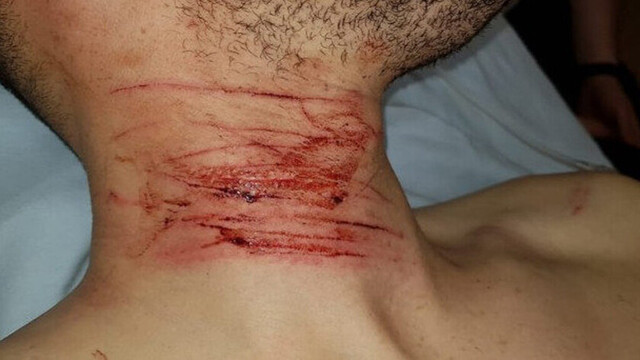Tarija: Se cortó el cuello tras discutir con su esposa