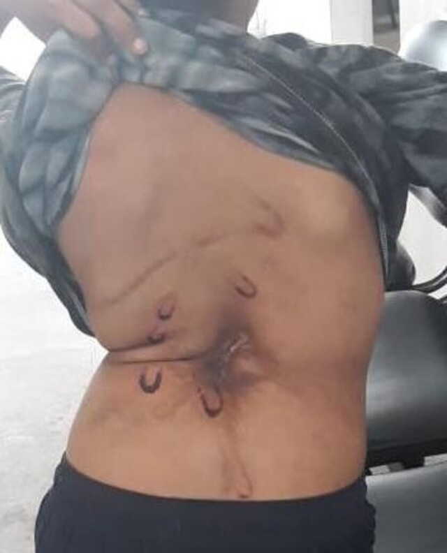 Madre y padrastro a la  cárcel por flagelar a niño