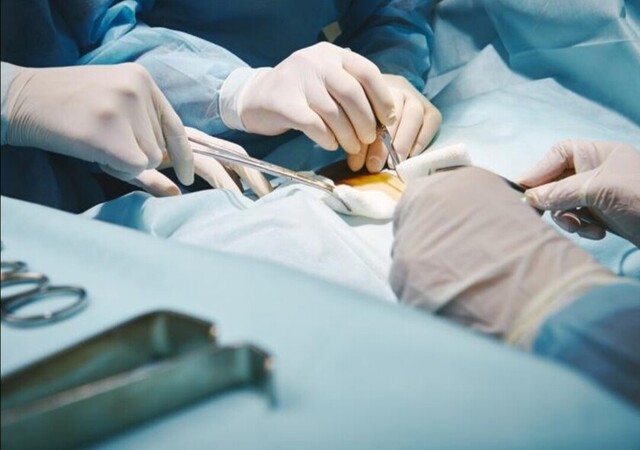 Extirpan un tumor que tenía pelos y dientes