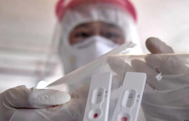 Hospital Regional recibe lote de 250 test rápidos de Covid para Tarija