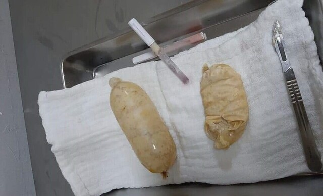 Detención preventiva a "mula" que transportaba cocaína en Tarija