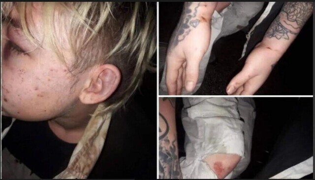 Detienen a policías argentinos por golpear y robar a joven