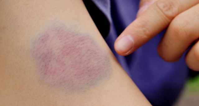 Fueron a cobrar una deuda y acabaron siendo golpeadas