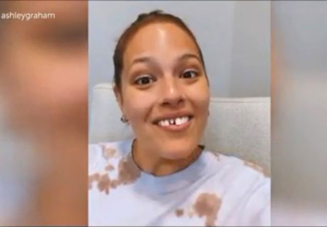 Ashley Graham  se rompió un  diente y lo contó 