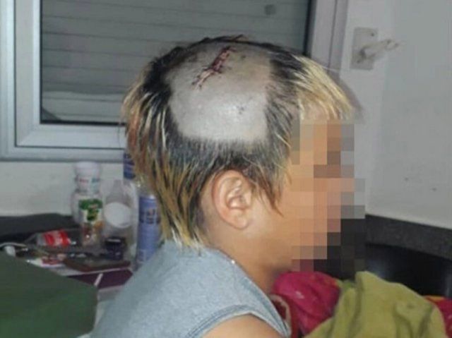 Policías golpearon a nene con una escopeta