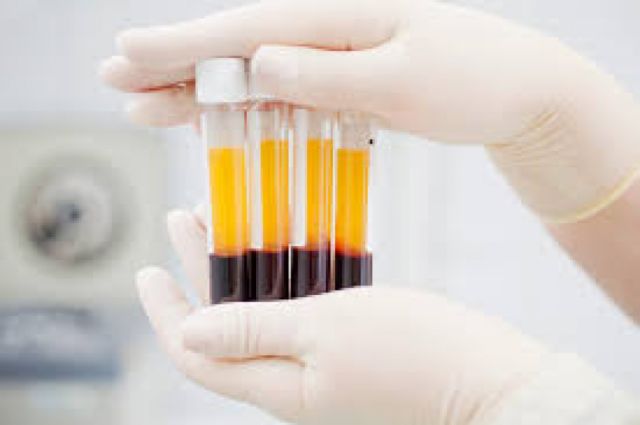 Senado sanciona Ley que impulsa donación de plasma hiperinmune