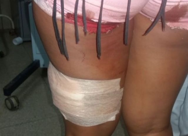 Una mujer fue apuñalada  por otra en una fiesta social