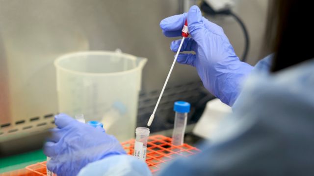 Ministerio obliga a los laboratorios a reportar todos los casos reactivos de pruebas rápidas a los Sedes