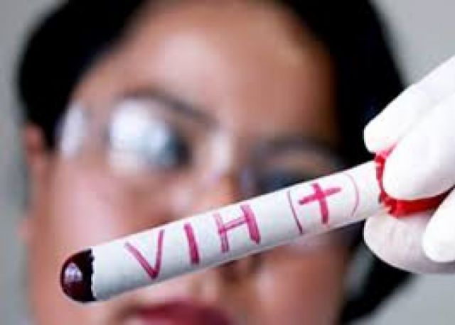 Salud reporta 47 casos de VIH-Sida en lo que va del año en el departamento de Tarija