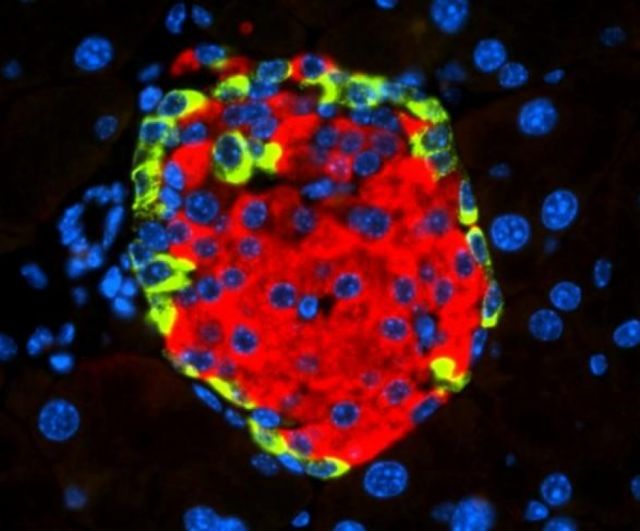 Describen cómo un virus puede causar diabetes