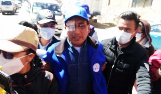 Jefe del MAS en El Alto denuncia que fue agredido y teme perder la vista de un ojo