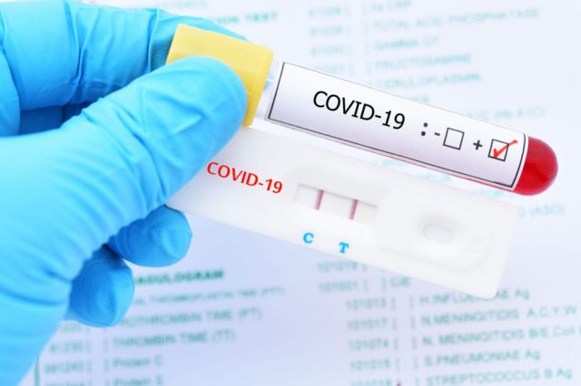 Tarija se acerca a 16 mil casos coronavirus