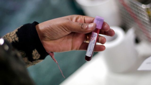 Sedes Tarija procesó 40 muestras de laboratorio el domingo