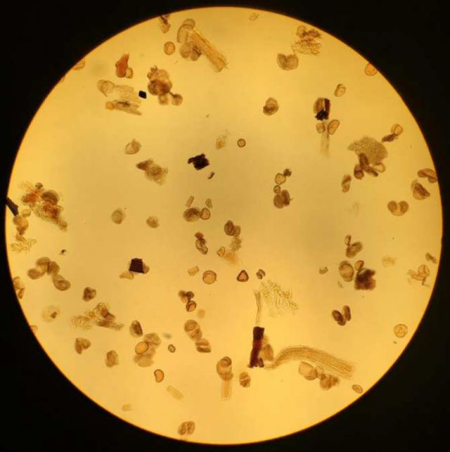 Polen y coronavirus