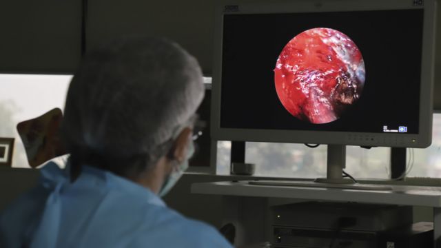 Muere en la India un paciente con hongo negro, blanco y amarillo al que también diagnosticaron covid-19 