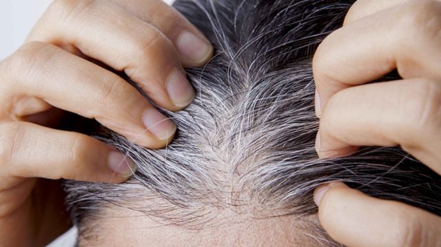 ¿El estrés encanece el cabello?