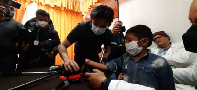 Tarija: Isaías ya recibió la primera prótesis 3D de mano 