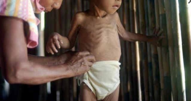 Baja cobertura de micronutrientes amenaza con agravar 3 enfermedades infantiles en Tarija