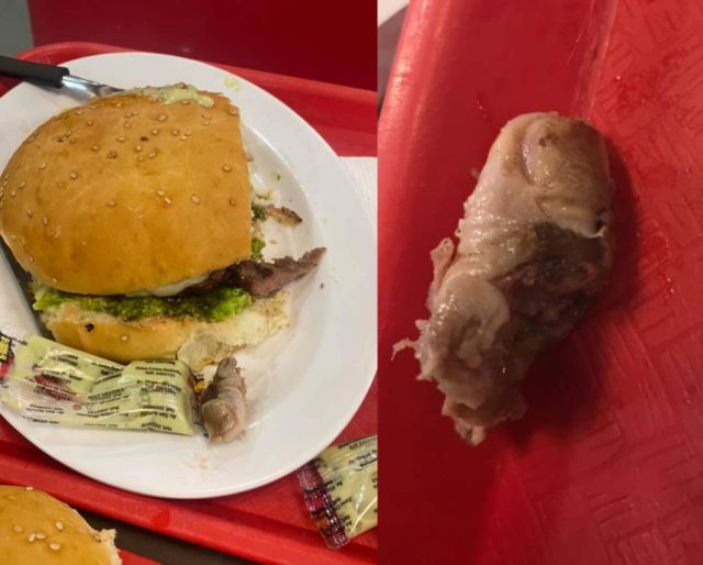 Confirman que dedo encontrado en una hamburguesa en Santa Cruz es real 