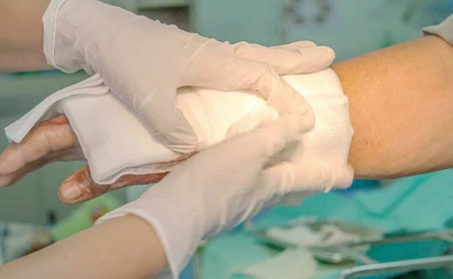 Sujeto causa quemaduras de primer y segundo grado a su esposa en Yacuiba-Tarija