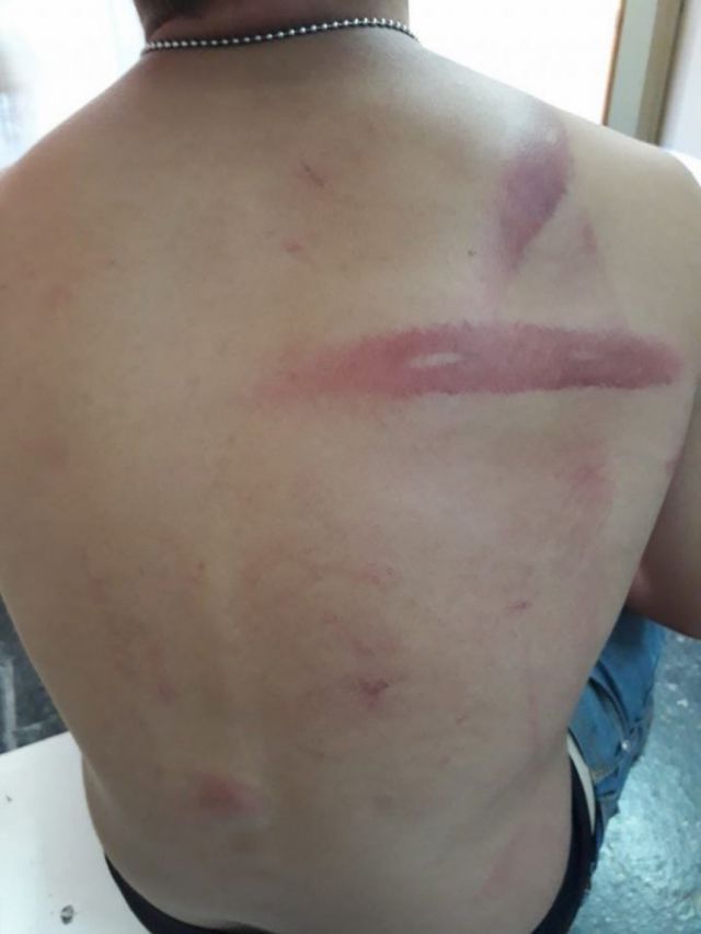 Sujeto fue amenazado y golpeado por sus parientes en Villa Montes