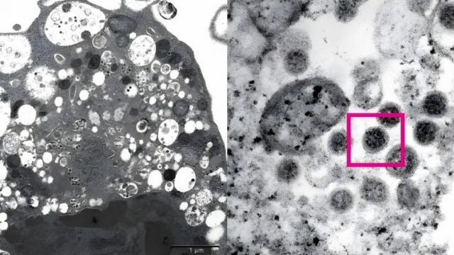 Qué se sabe de la nueva versión de la variante ómicron, que se detectó en más de 40 países 
