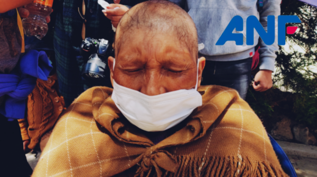 "No me quería mirar al espejo", mujeres con cáncer sufren por la caída del cabello y burlas