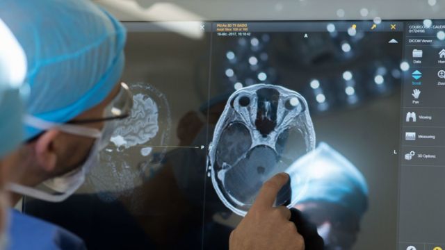 Escanear el cerebro con más fuerza magnética mejora el tratamiento del párkinson