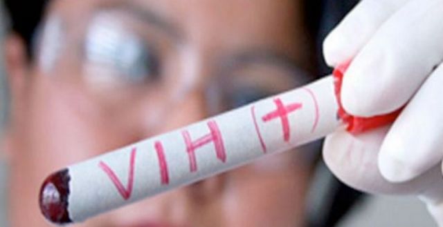 Tarija registra 56 casos de VIH en lo que va del 2022
