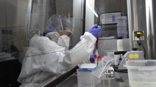 El 91% de casos de viruela símica están en Santa Cruz