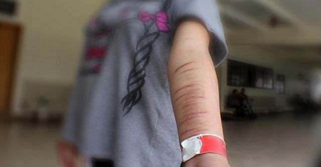 Alertan por casos de “cutting” en unidades educativas de Tarija
